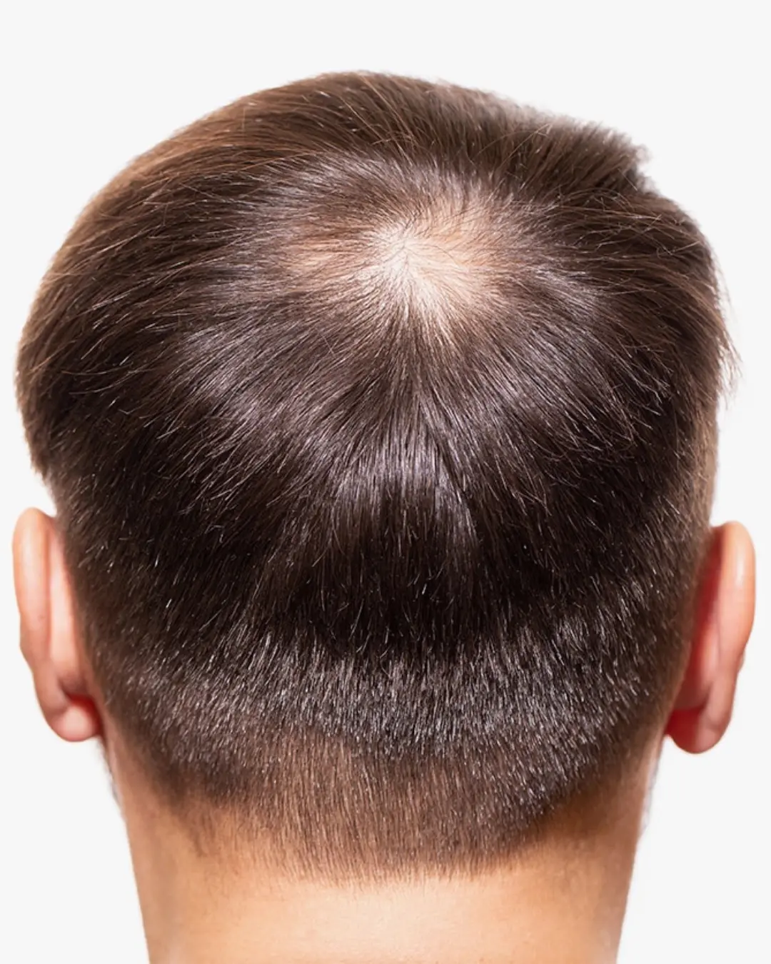 قبل حقن الخلايا الجذعية